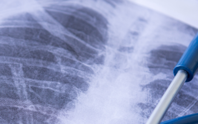 La Clínica pone en marcha servicios especiales post-Covid19